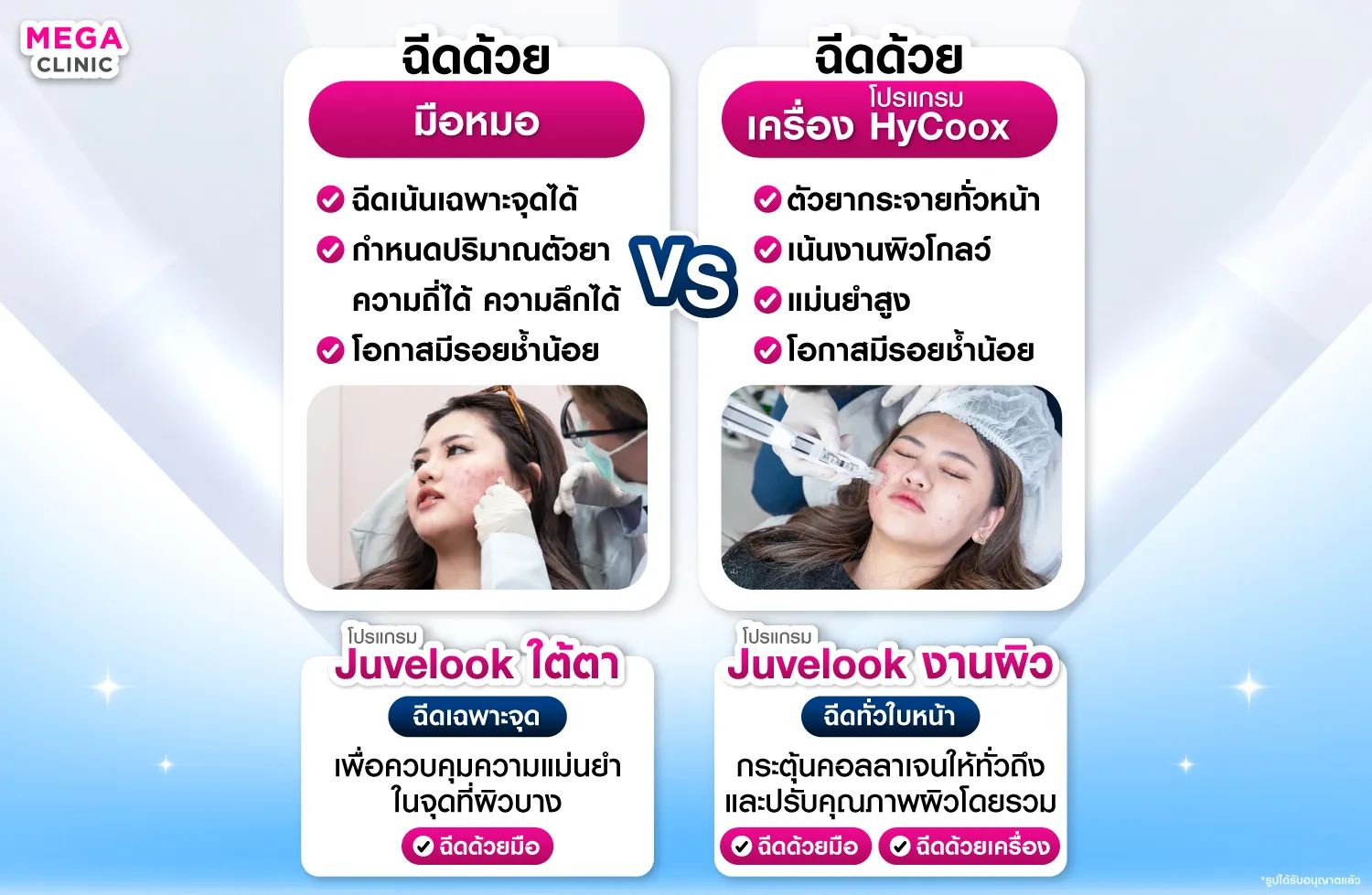 Juvelook ฉีดมือ vs ฉีดเครื่อง