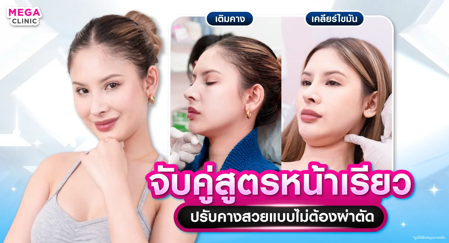 ปรับหน้าเรียว ลดเหนียง ปรับคางสวยแบบไม่ต้องผ่าตัด