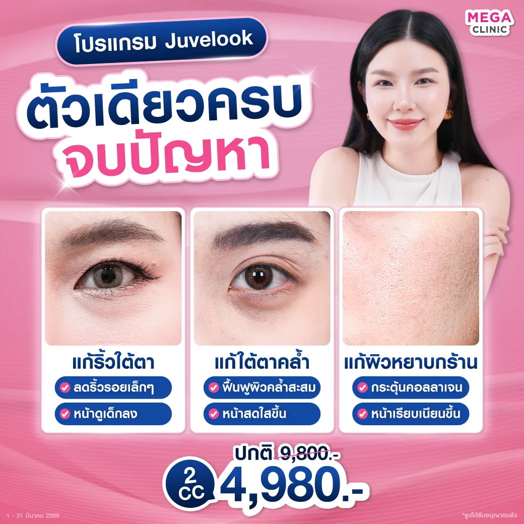 Web_แปล_01022026_01_Mickey_result