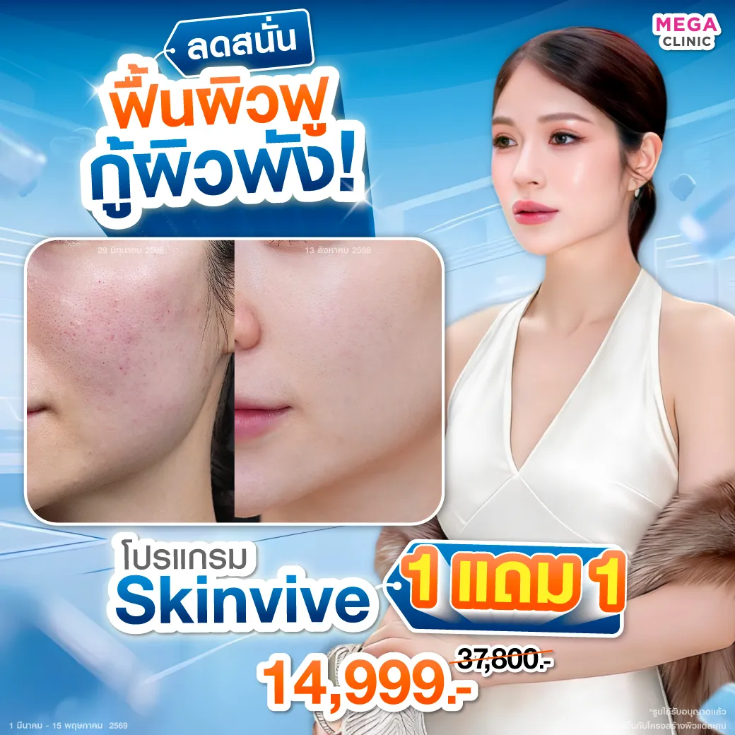 Web_แปล_18022026_Mickey_result