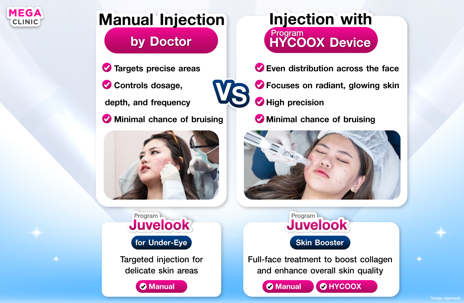 Juvelook ฉีดมือ vs ฉีดเครื่อง