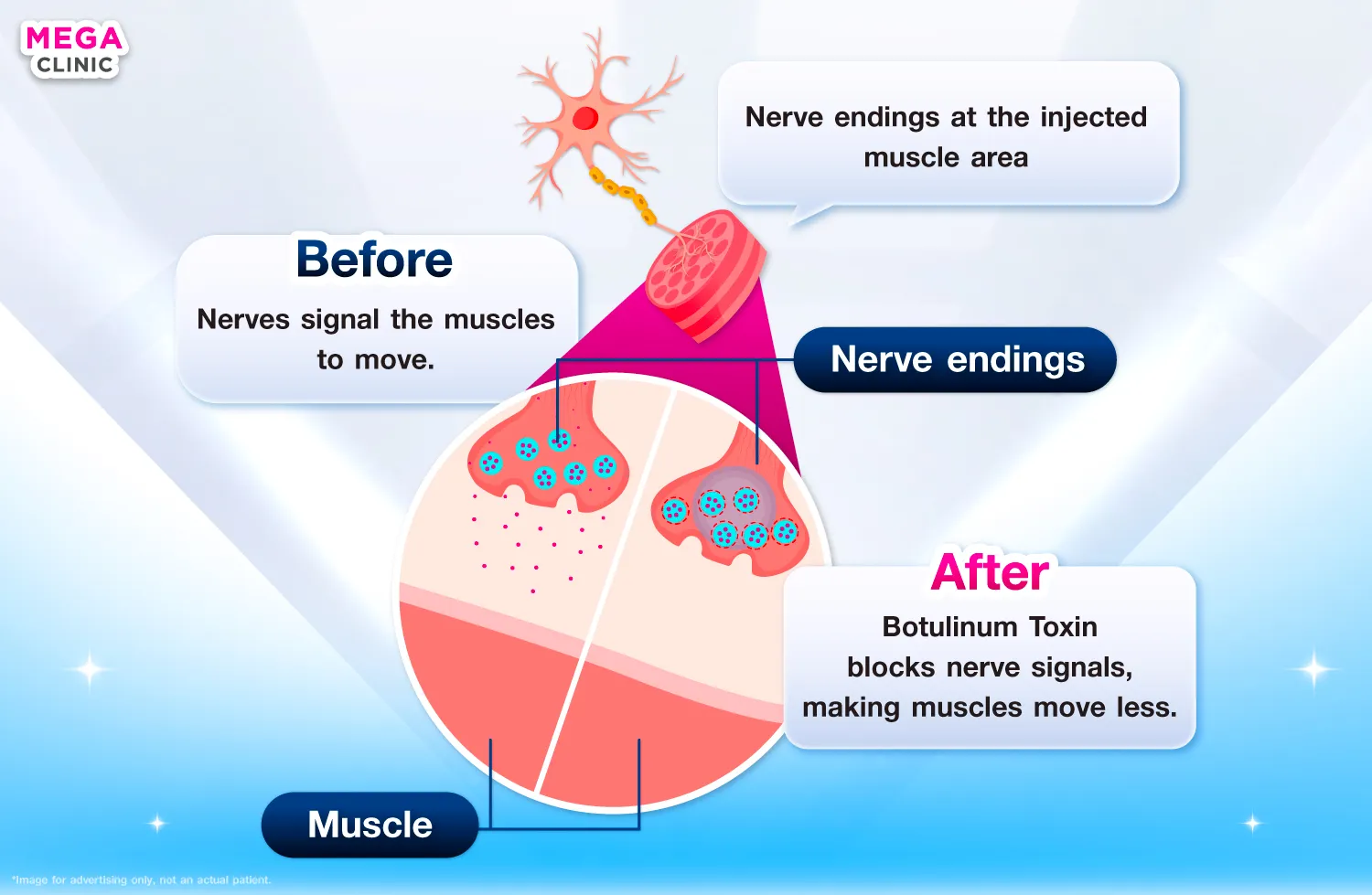 โบท็อกทำงานยังไง