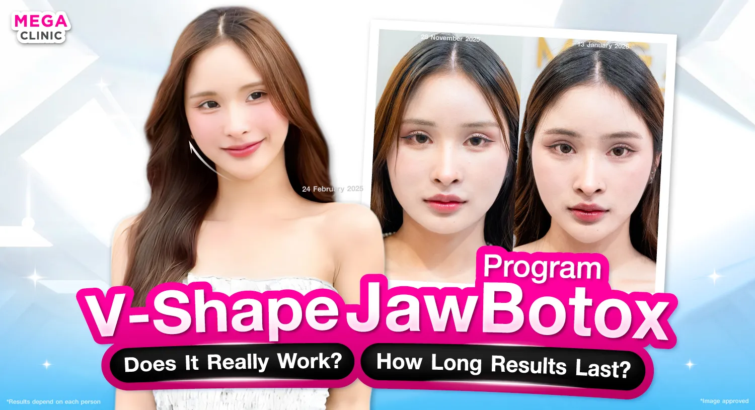 ฉีดโบท็อกกราม กี่วันเห็นผล