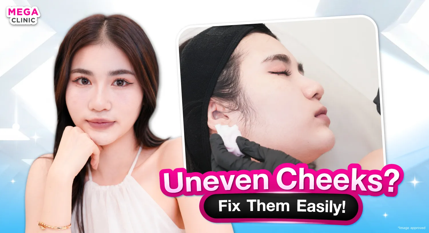 ฟิลเลอร์แก้มตอบ คืออะไร ช่วยเรื่องอะไรบ้าง