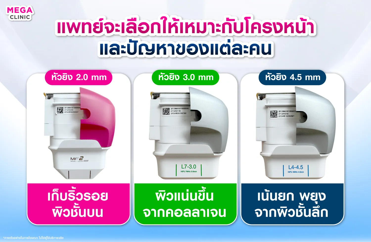 Ultraformer III หัวยิงระดับต่างๆ ตั้งแต่เก็บรายละเอียดริ้วรอยเล็ก ๆ กระตุ้นคอลลาเจน และ ยกกระชับแก้ม เหนียง กรอบหน้า