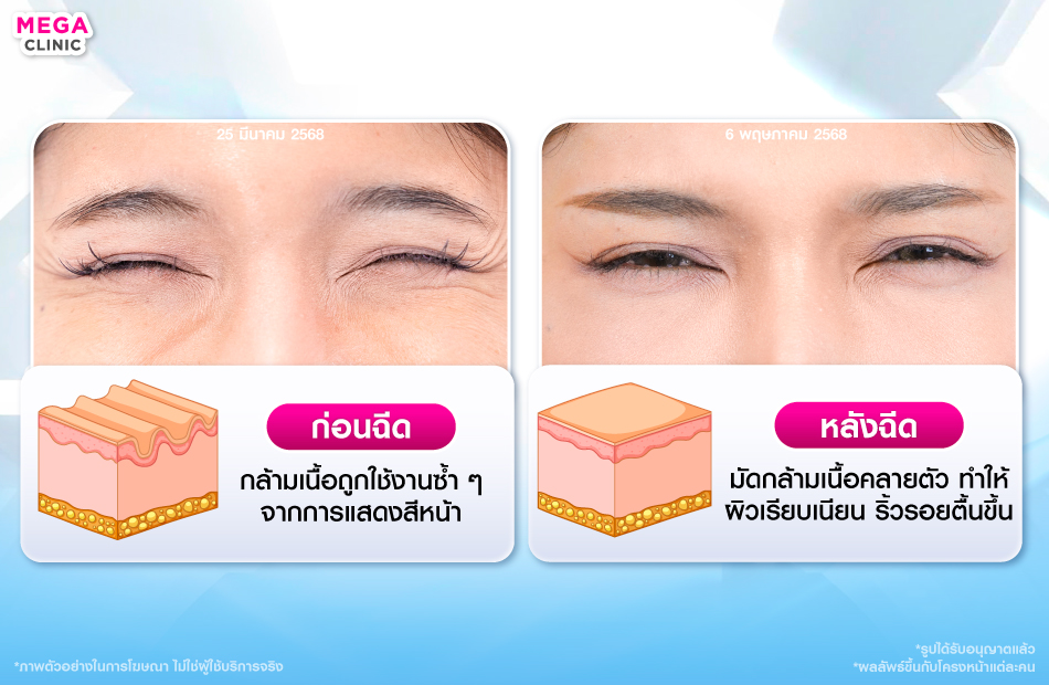 โบท็อกช่วยอะไร