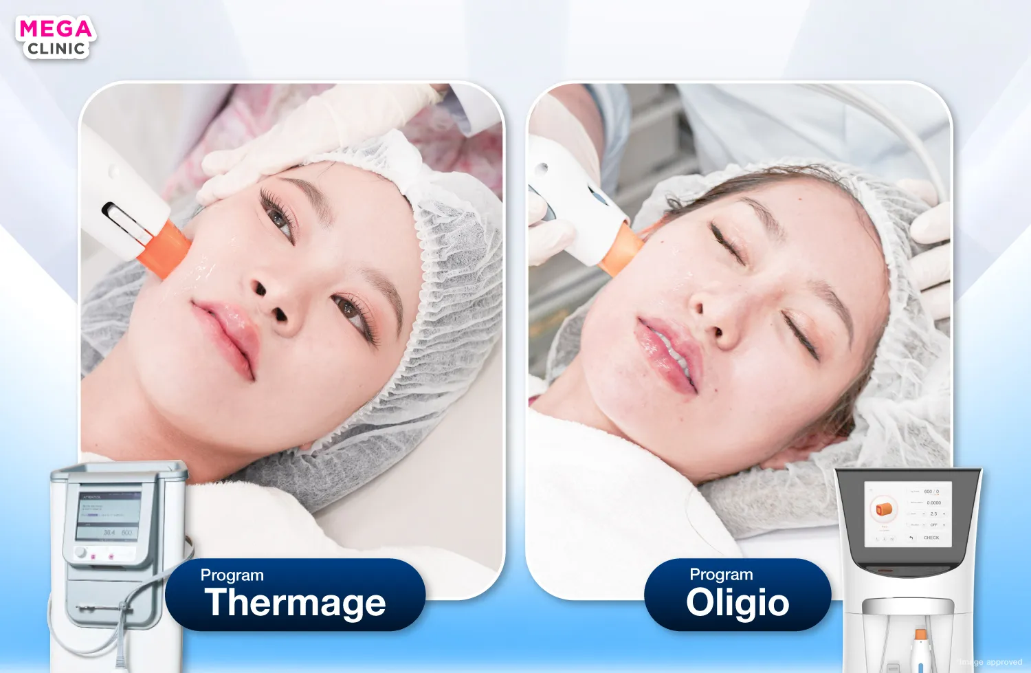 Thermage และ Oligio