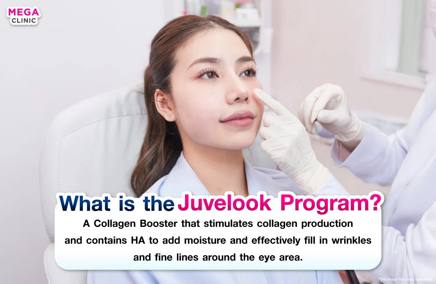 Juvelook คืออะไร