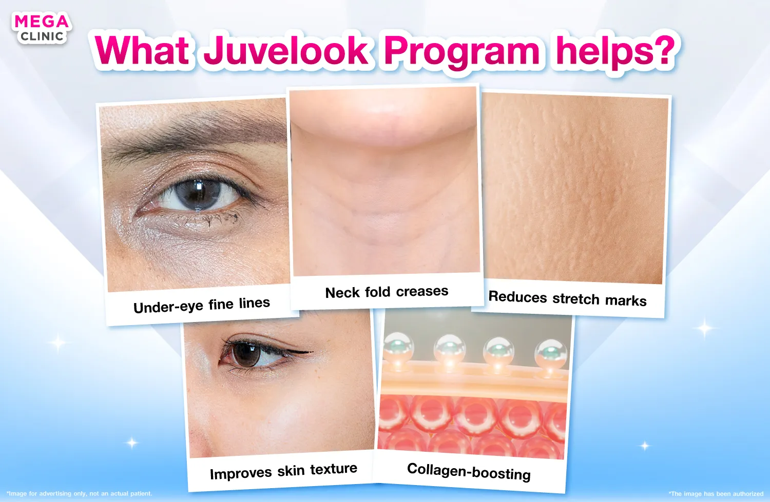 What Juvelook can do