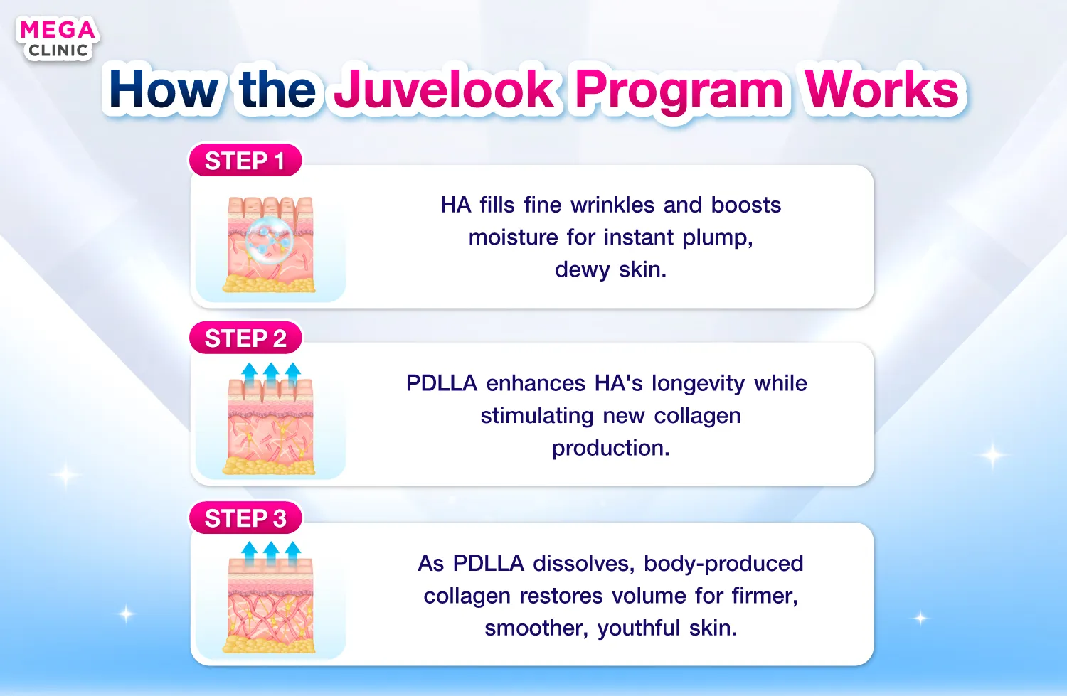 Juvelook ทำงานยังไง