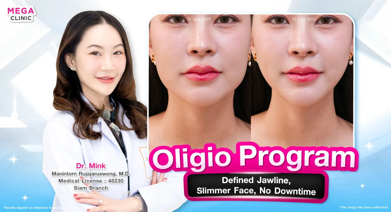 oligio คืออะไร