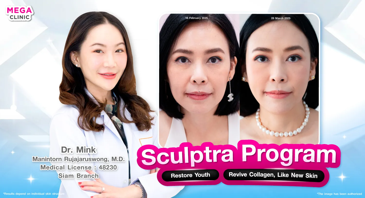 sculptra คืออะไร