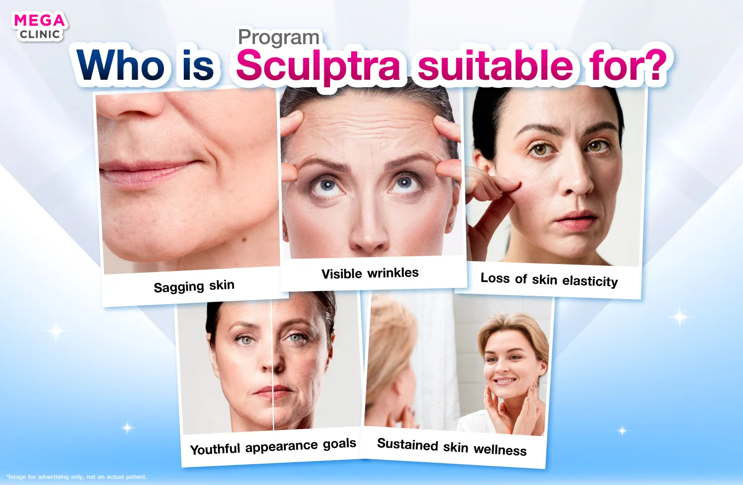 sculptra เหมาะกับใคร
