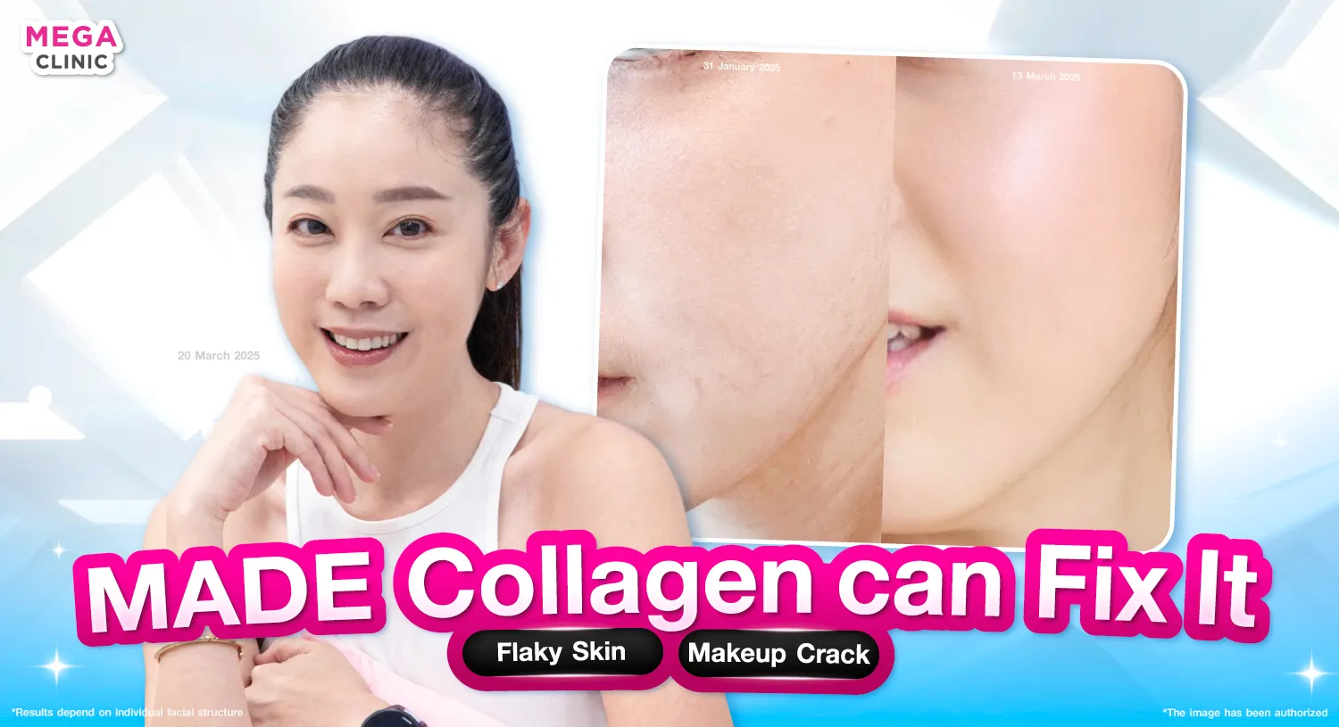 ฉีดหน้าใส ลดหน้าขุย แต่งหน้าติด