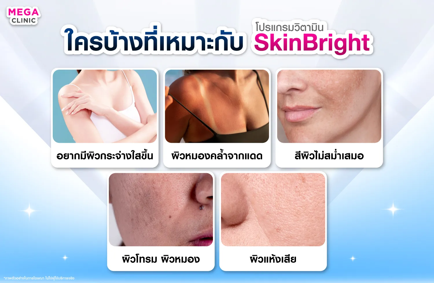 SkinBright เหมาะกับใคร