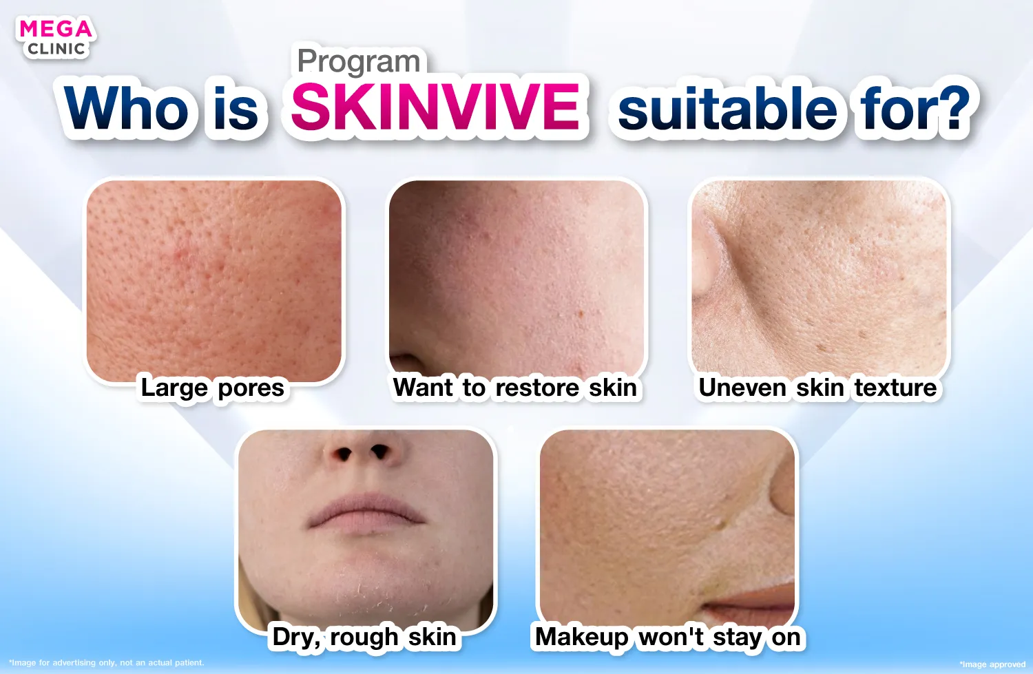 What does Skinvive help with?