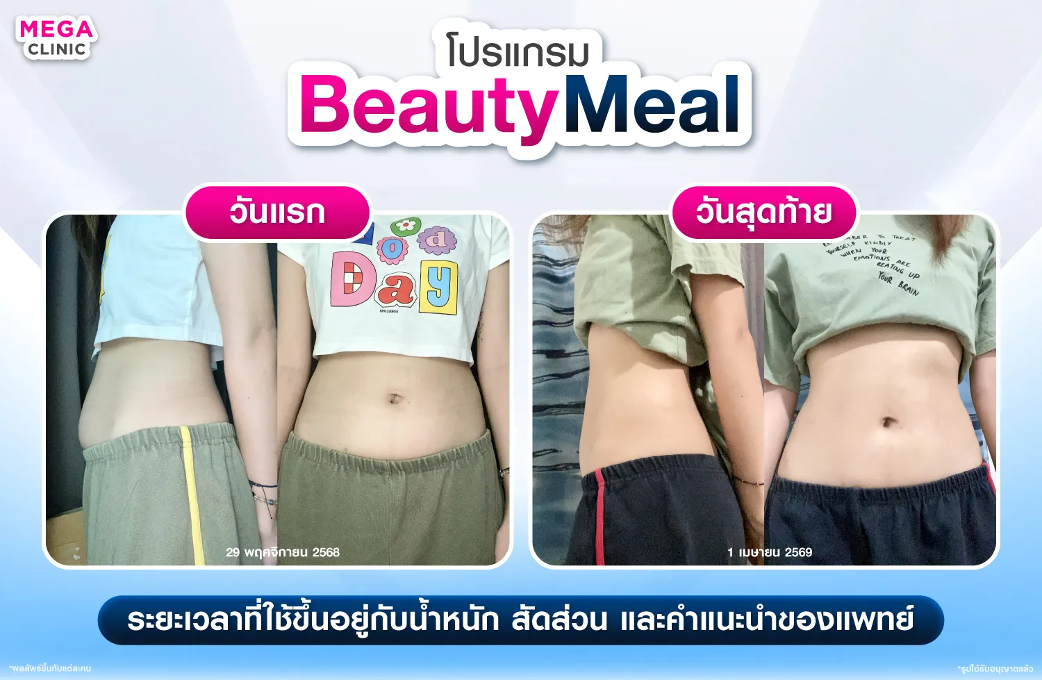 ก่อน หลัง ใช้ BeautyMeal ปากกาลดน้ำหนัก
