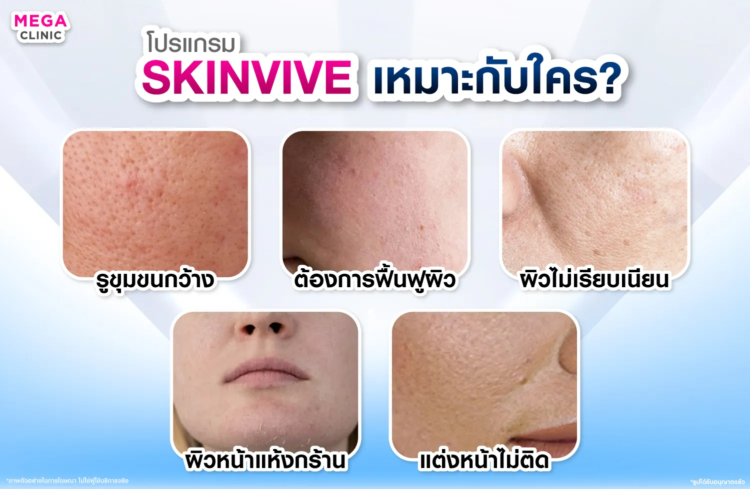 Skinvive ช่วยเรื่องอะไร