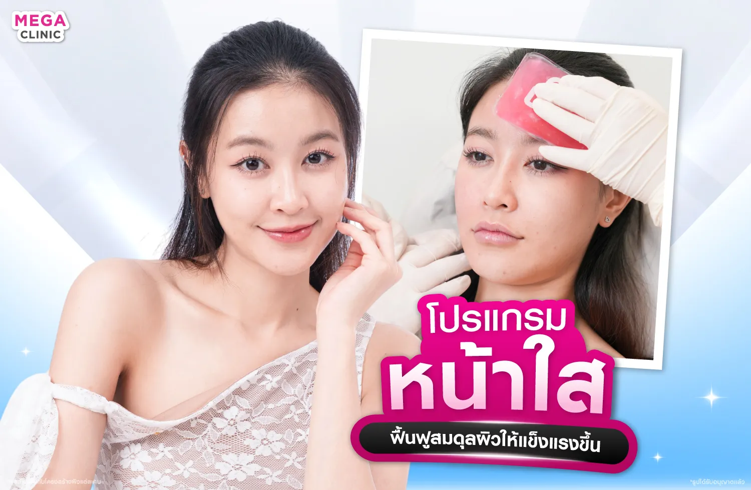 ฉีดหน้าใส (Meso Bright) เหมาะกับผิวเสียสมดุลและเป็นสิวง่าย