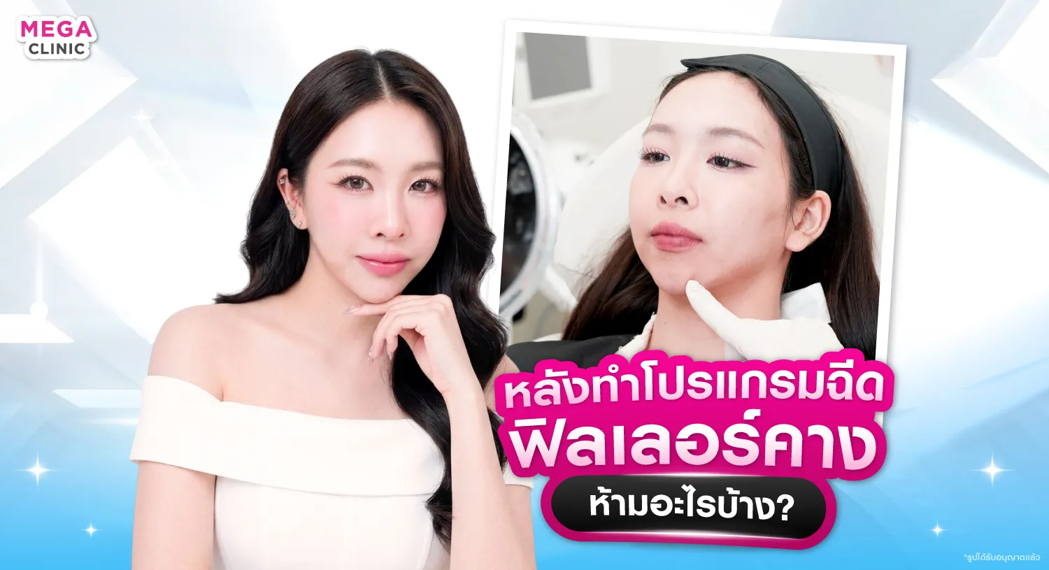 หลังทำฉีดฟิลเลอร์คางห้ามอะไรบ้าง?
