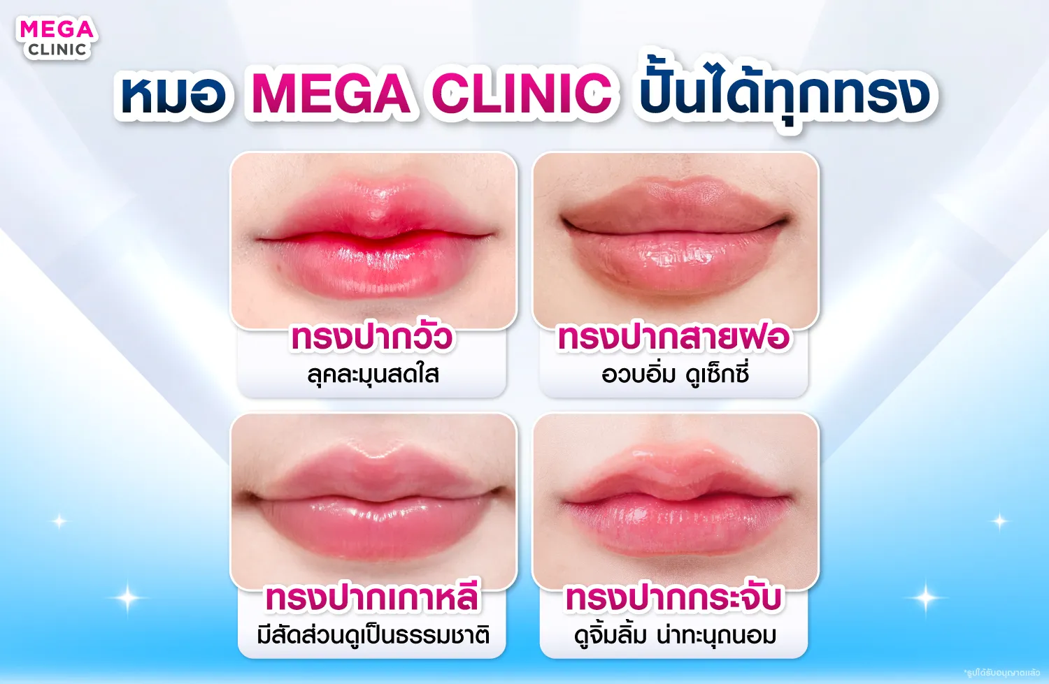 ฟิลเลอร์ปากวัว ปากกระจับ ปากเกาหลี สายฝอ ต่างกันอย่างไร ?