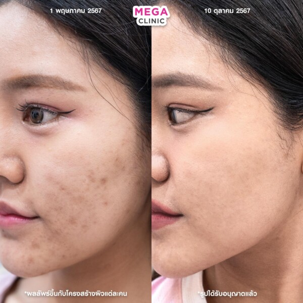 รีวิว Aurawhite (ออร่าไวท์) 5