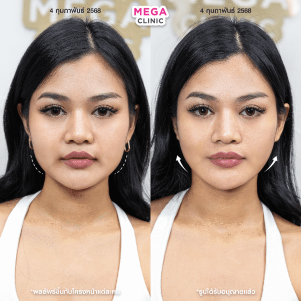 รีวิว Oligio