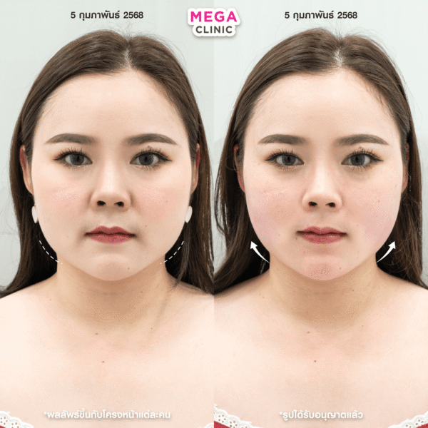 รีวิว Oligio