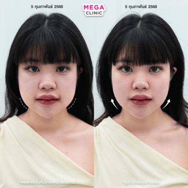 รีวิว Oligio