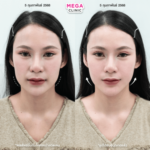 รีวิว Oligio