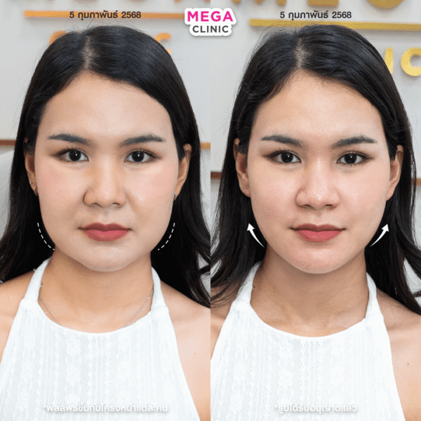 รีวิว Oligio