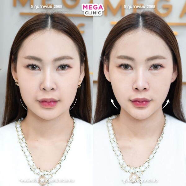 รีวิว Oligio