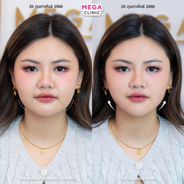 รีวิว Oligio