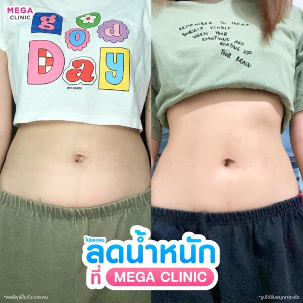 รีวิว ปากกาลดน้ำหนัก