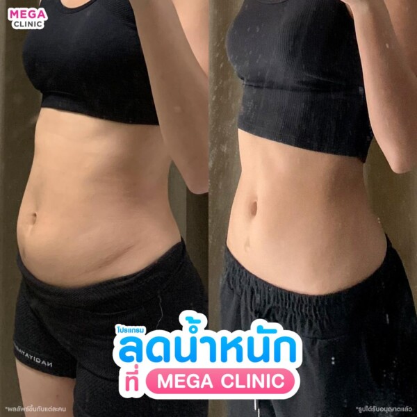 รีวิว ปากกาลดน้ำหนัก