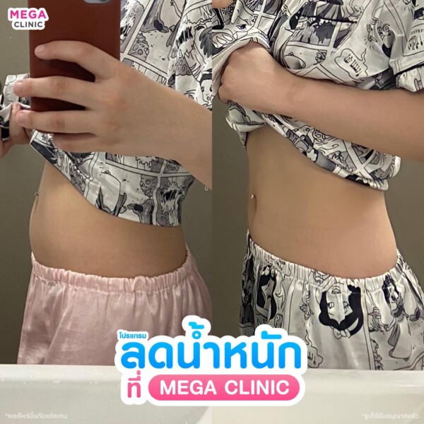 รีวิว ปากกาลดน้ำหนัก