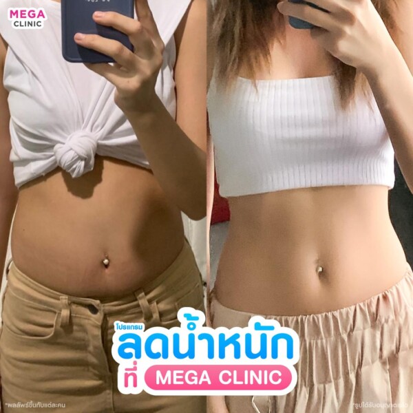 รีวิว ปากกาลดน้ำหนัก