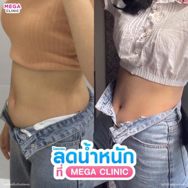 รีวิว ปากกาลดน้ำหนัก