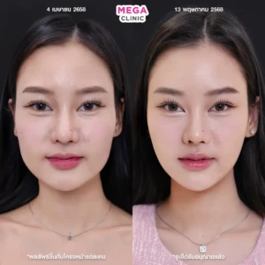 รีวิว โบกราม แฟต