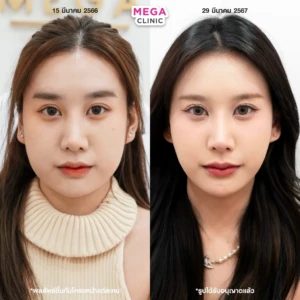 รีวิว โบกราม แฟต