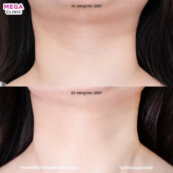 รีวิว juvelook