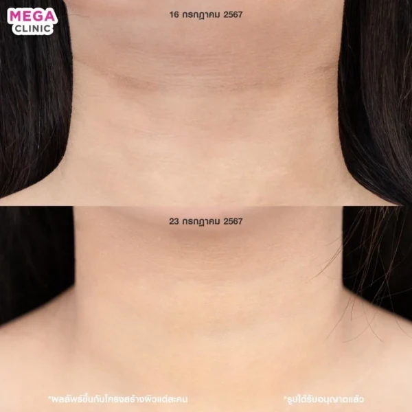 รีวิว juvelook