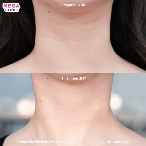 รีวิว juvelook