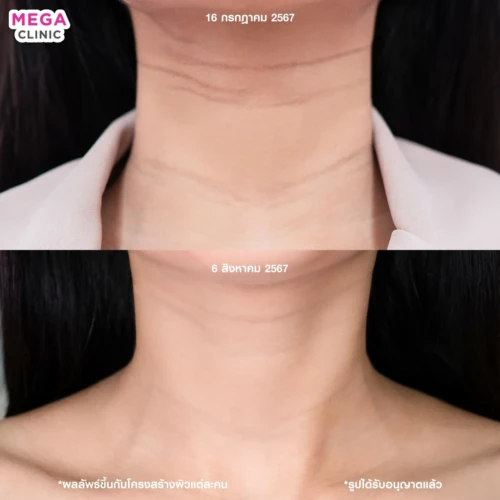 รีวิว juvelook