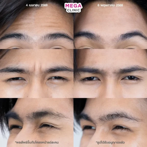 รีวิว โบริ้วรอย