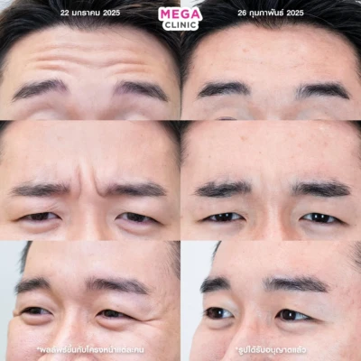 รีวิว โบริ้วรอย