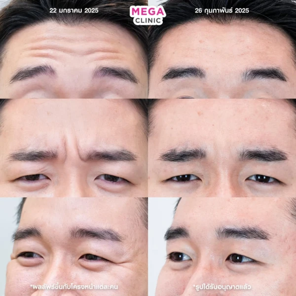 รีวิว โบริ้วรอย