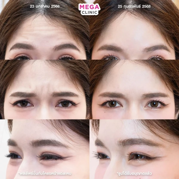 รีวิว โบริ้วรอย