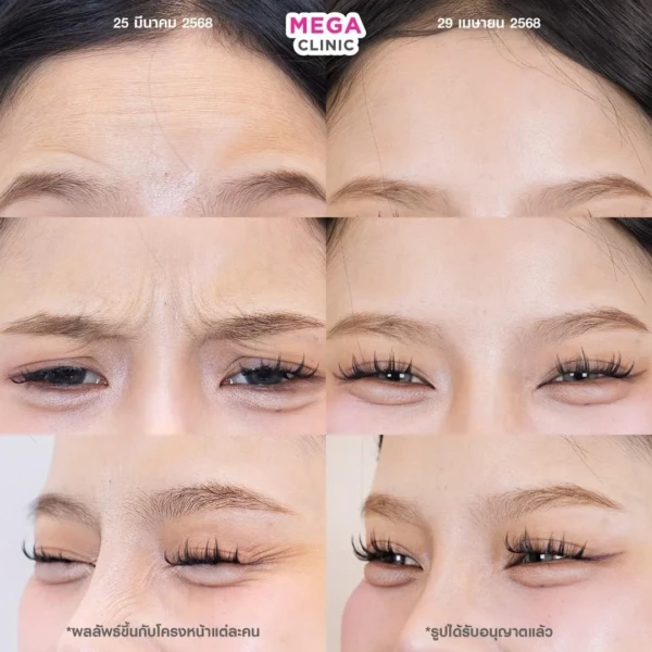 รีวิว โบริ้วรอย