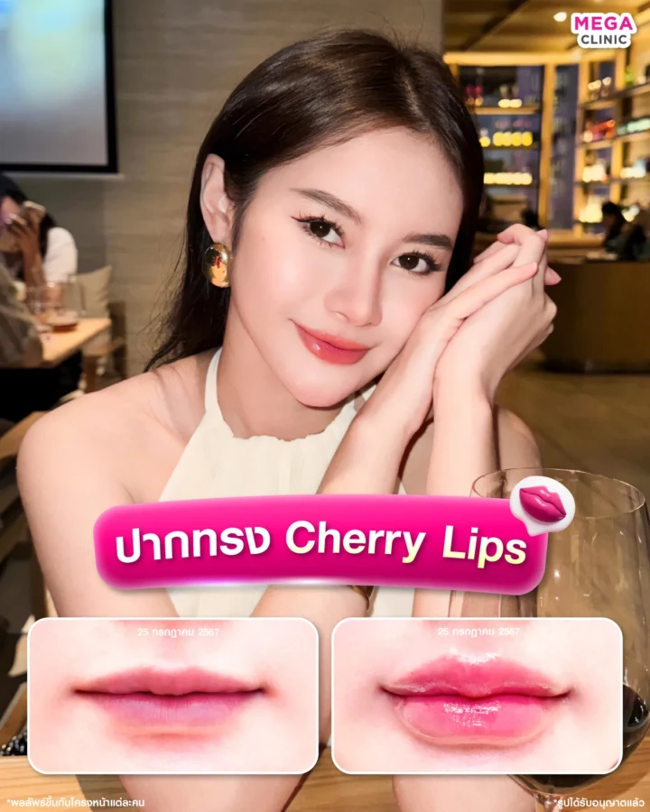 ปากทรง Cherry Lips
